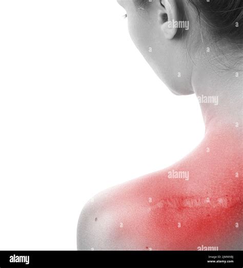 Woman Scar Back Hi Res Stock Photography And Images Alamy