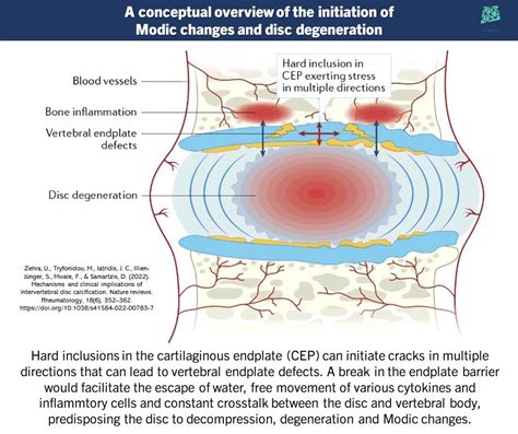 Physio Meets Science On Twitter Mechanisms And Clinical Implications