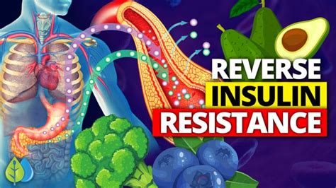 Top 13 Foods To Reverse Insulin Resistance