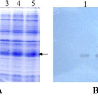 Sdspage And Western Blotting Analysis Of Recombinant His Tagged