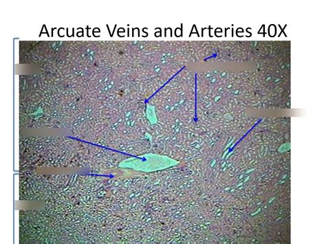 ARCUATE VEINS & ARTERIES Diagram | Quizlet