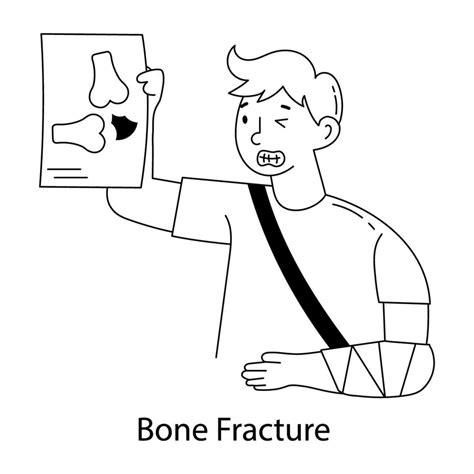 Trendy Bone Fracture 46104989 Vector Art at Vecteezy