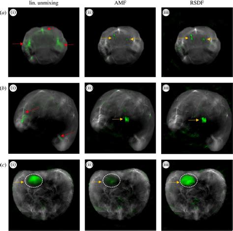 Spectral Unmixing Techniques For Optoacoustic Imaging Of Tissue