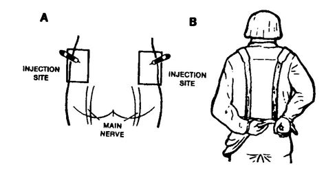 Nerve agent - Alchetron, The Free Social Encyclopedia