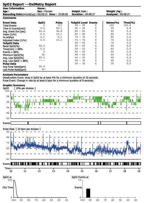 Does this pulse oximetry report look like sleep apnoea? | CPAPtalk.com