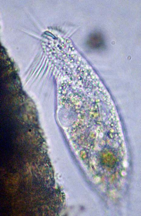 Protist Cell Under Microscope