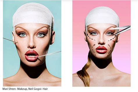 Cosmetic Surgery Face Plastic Surgery Faces Cosmetics Cosmetic Surgery