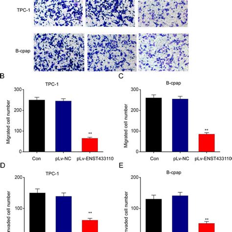 Overexpression Of Lncrna Enst433110 Suppresses Tc Cell Migration A C