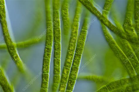 Algae Light Micrograph Stock Image C0594087 Science Photo Library