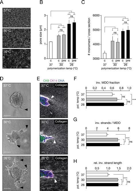 Increasing Collagen Fiber Thickness Increases Breast Cancer Invasion A