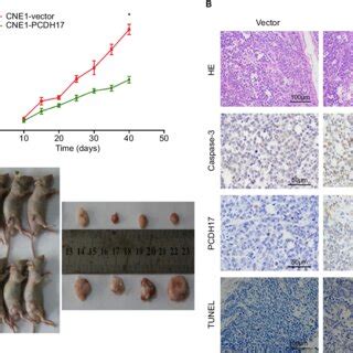 PCDH17 Inhibits Tumor Growth In Nude Mice Notes A Cne1 PCDH17 And