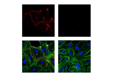 Ve Cadherin Antibody Cell Signaling Technology