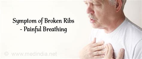 Broken or Bruised Ribs - Types, Causes, Symptoms, Risks, Complications ...