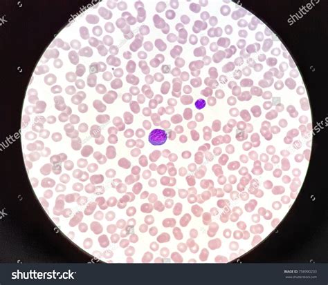 Human Peripheral Blood Smear Under 100x Stock Photo 758990203 ...