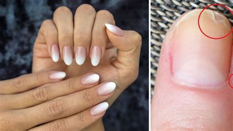 3 Astuces Pour Renforcer Et Soigner Ses Ongles Mous Et Cassants