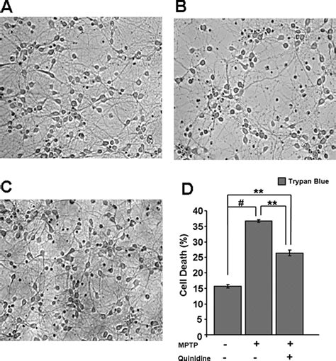 Effect Of Mptp Treatment On Primary Mouse Brain Neurons Primary