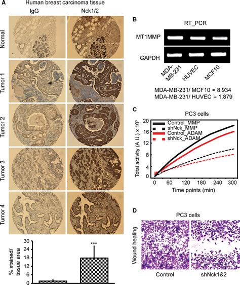 Nck Expression And Metalloprotease Activity In Cancer A Download