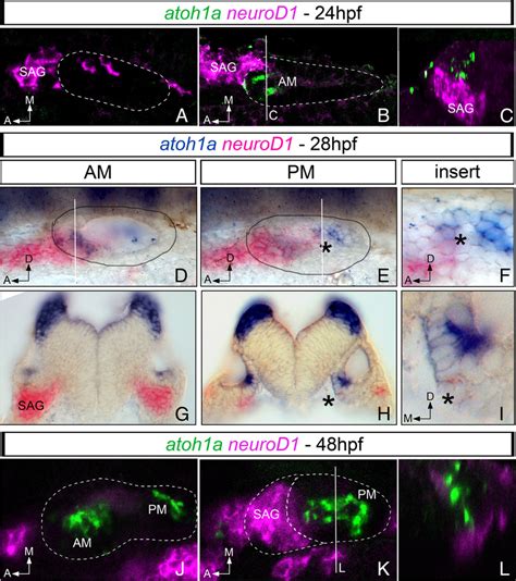 Expression Of Proneural Genes For Neurons And Hair Cells Overlaps In