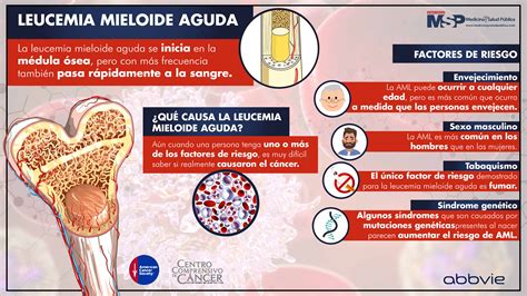 Leucemia Mieloide Aguda Sintomas ROAREDU