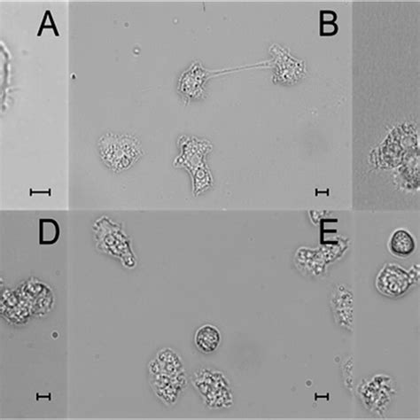 Light Micrographs Of Live Acanthamoeba Trophozoites And Cysts In Download Scientific Diagram