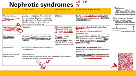 Nephritic And Nephrotic Syndromes Renal System Step 1 Simplified