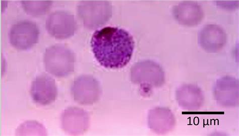 Plasmodium vivax – Gametocyte – Parasitology