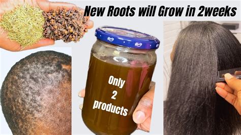 CLOVES ROSEMARY WATER FOR FAST HAIR GROWTH YouTube