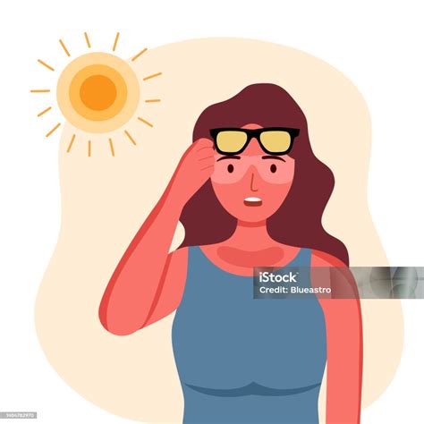 Young Woman With Skin Sunburn Under Strong Sunlight In Flat Design