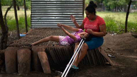 Alisson Perdi Una Pierna Pero No El Deseo De Vivir Noticias De El