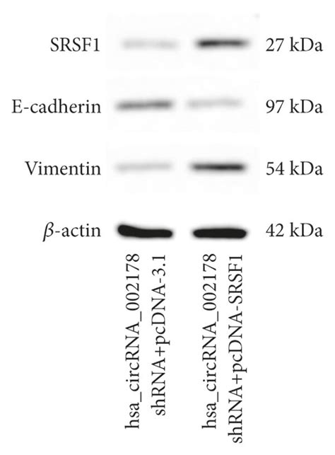 SRSF1 Overexpression Reversed The Effects Of Hsa CircRNA 002178