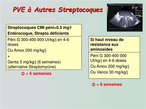 Ppt Prise En Charge D’une Endocardite Infectieuse Sur Prothese Powerpoint Presentation Id