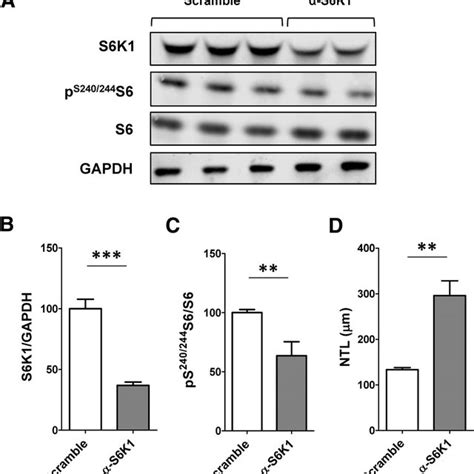 Sirna Mediated Knockdown Of S6k1 Promotes Neurite Outgrowth In Primary