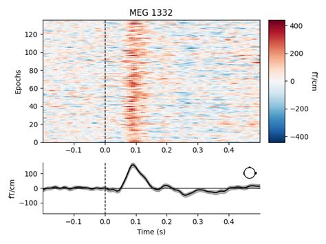 Overview Of Meg Eeg Analysis With Mne Python Mne Documentation