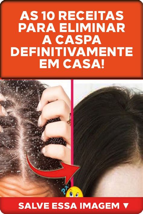 As Receitas Para Eliminar A Caspa Definitivamente Em Casa As