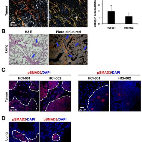 Cafs Promote Primary Tumor Growth And Lung Metastasis In Tnbc Mouse