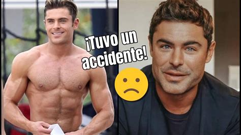 Zac Efron Por Fin Explica La Causa De La Transformación De Su Cara En