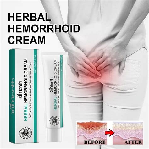 Herbal Hemorrhoid Relieves Anal Itching Eliminates Hemorrhoids