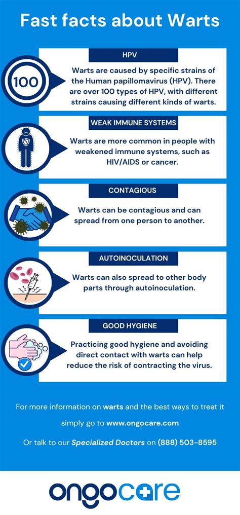 Warts - Causes, Symptoms, Diagnosis, and Treatment