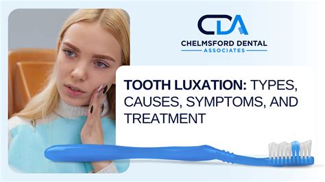 Tooth Luxation: Types, Causes, Symptoms, and Treatment