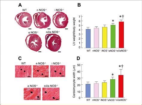 Left Ventricular Lv And Cardiac Myocyte Hypertrophy In Month Old