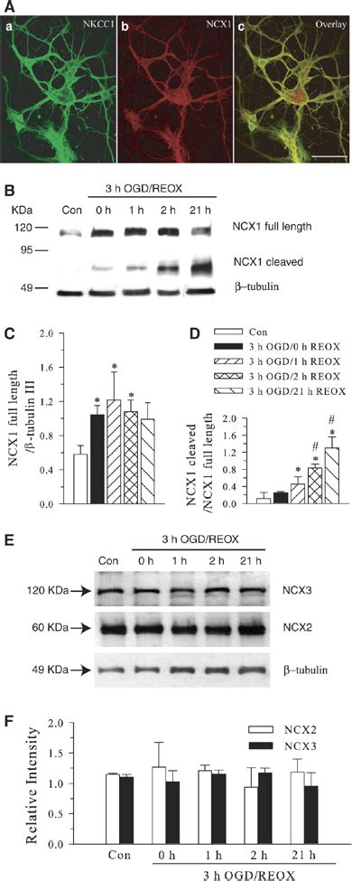 Oxygen And Glucose Deprivation Reoxygenation Mediated Changes In Ncx