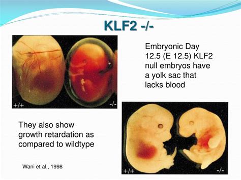 Ppt The Role Of Kr Ppel Like Factor In Erythroid Cells Powerpoint