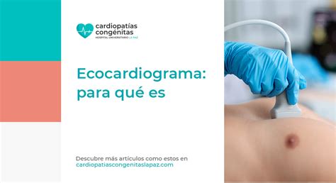 Ecocardiograma Para Qu Es Cardiopat As Cong Nitas La Paz