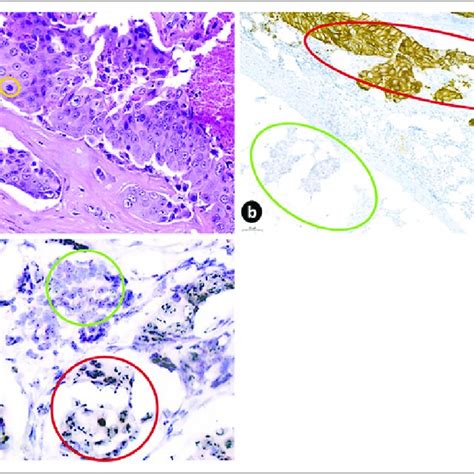 Histology Immunohistochemistry And Silver Enhanced In Situ