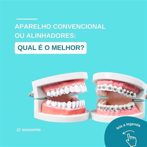 Pack De Artes No Canva P Dentistas Edit Veis Arquivos