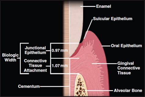 Epithelial Attachment