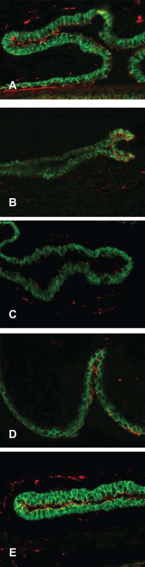 Labeling Of Tight Junctional Proteins In Conjunctiva Immunofluorescent