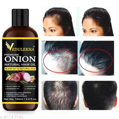 Vedulekha Onion Oil For Hair Regrowth Hair Fall Control Premium Hair