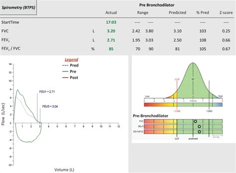 Basic Spirometry Testing And Interpretation For The Primary Care