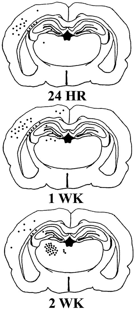 Schematic Of Tun El Stained Sections Of The Rat Brain 24 Hr 1 Week